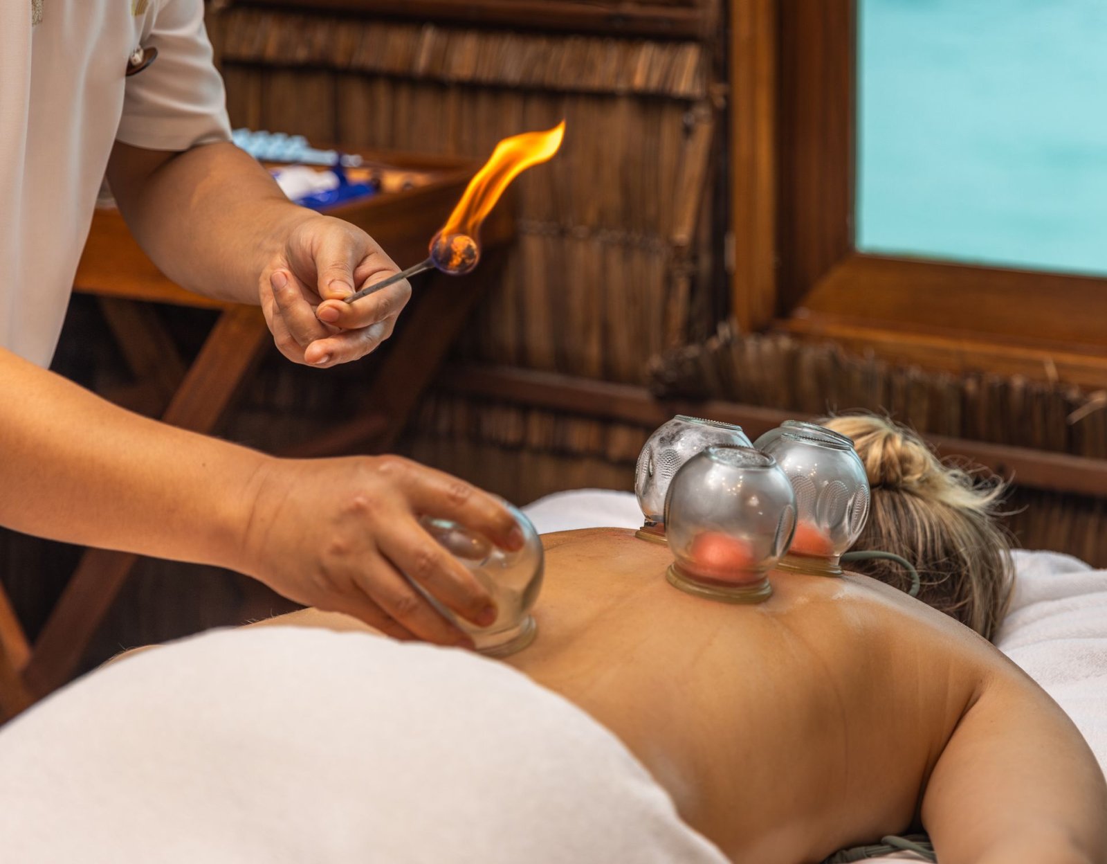 Cupping treatment